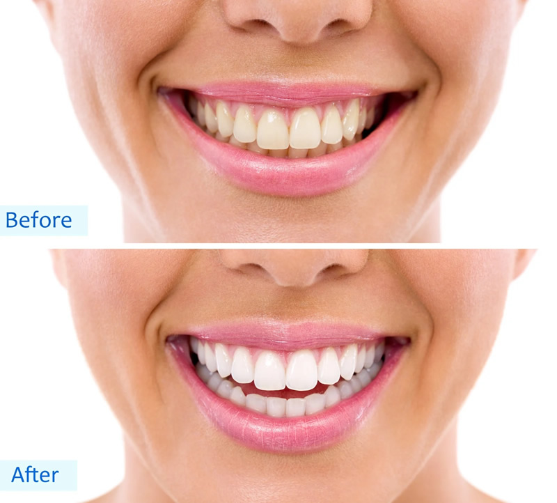 Cosmetic Dentistry